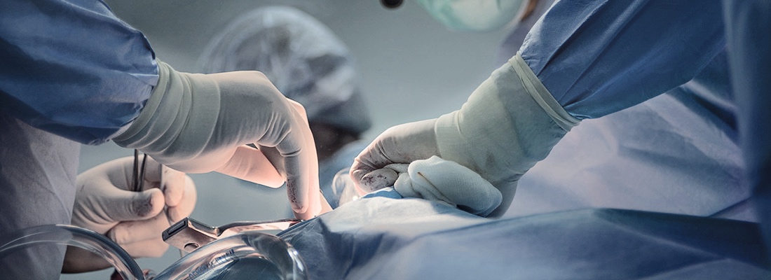 surgeons performing surgery on an anal fistula to make sure the fistula does not come back and understanding fistula recurrence